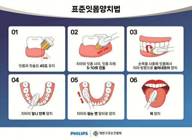 잇몸 중심으로 양치하는 '표준잇몸양치법' (사진=필립스코리아)