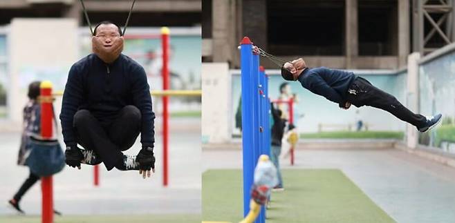 최근 중국에서 기이한 불면증 치료법이 확산되며 충격을 주고 있다. [사진=SNS]