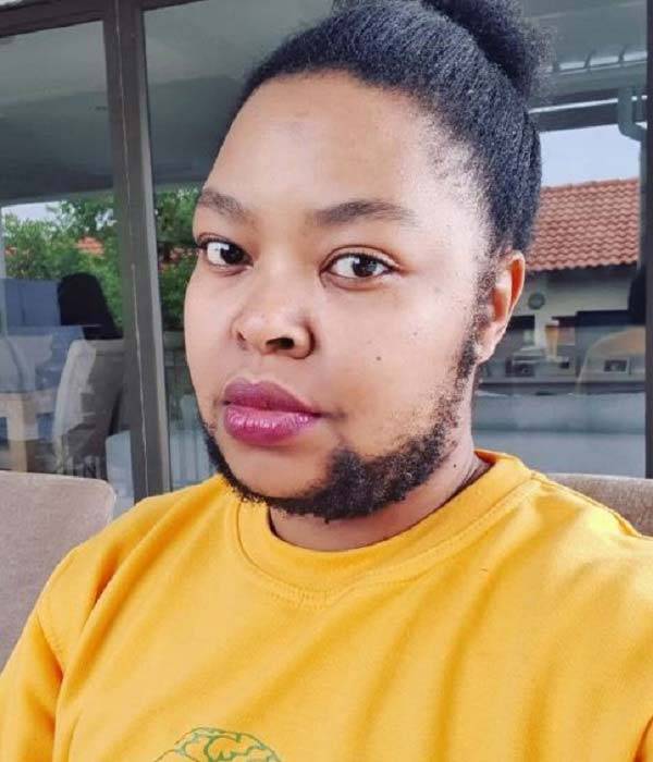 남아프리카의 한 40대 여성이 몸에 털이 과도하게 자라는 탓에 남성으로 오해받고 있다는 사연을 공개해 화제다./사진=니드투노우