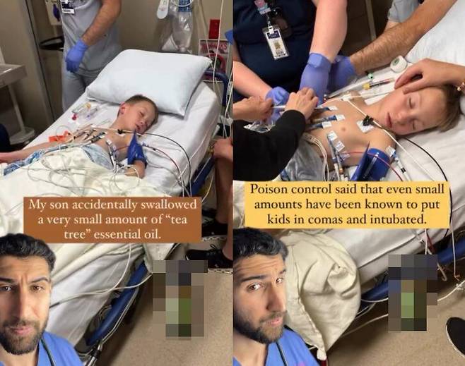 가정의학과 전문의인 세르메드 메제르 박사는 "티트리 오일을 소량만 삼켜도 1분 이내에 심각한 중독을 일으킬 수 있다"고 말했다. [사진=SNS]