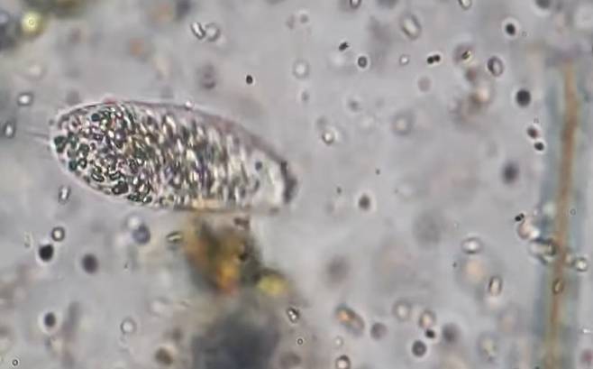 현미경으로 촬영한 뇌먹는 아메바. 인도 WION 방송 화면 캡처.