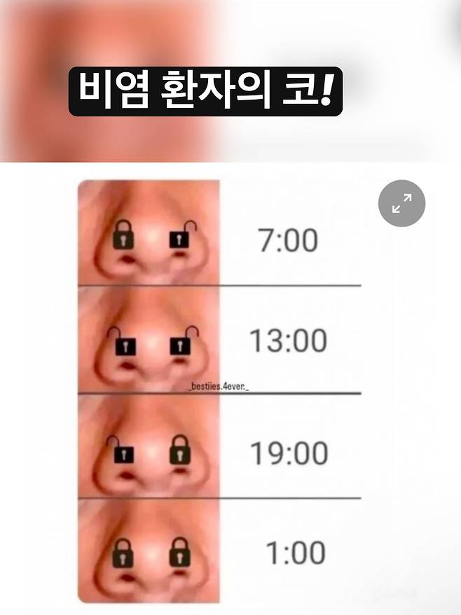 GoBSg_pa8AAg_oq.jpg 시간대별 비염환자의 코상태.jpg