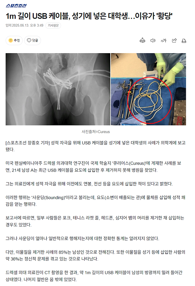 image.png 1m 길이 USB 케이블, 성기에 넣은 대학생…이유가 \'황당\'