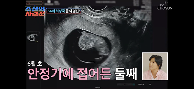 KakaoTalk_20250613_221755348_07.png 최성국 54세에 둘째 임신성공.jpg