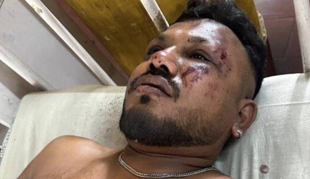 에어인디아 추락사고의 유일한 생존자로 알려진 비슈와시 쿠마르 라메시가 병원으로 이송돼 치료를 받고 있다. 힌두스탄타임스 캡처