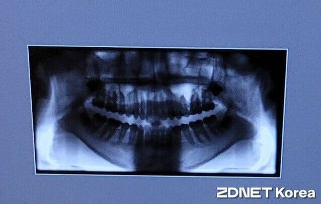 치과 x-ray
