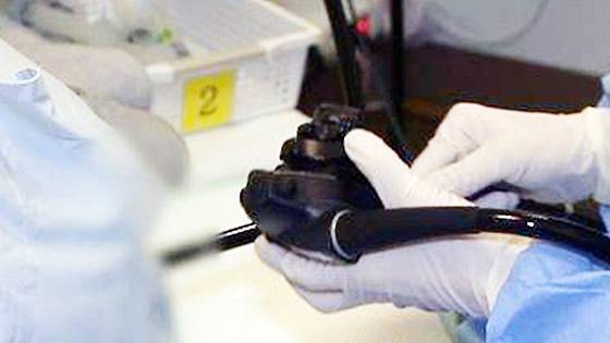 대장 내시경. 연합뉴스