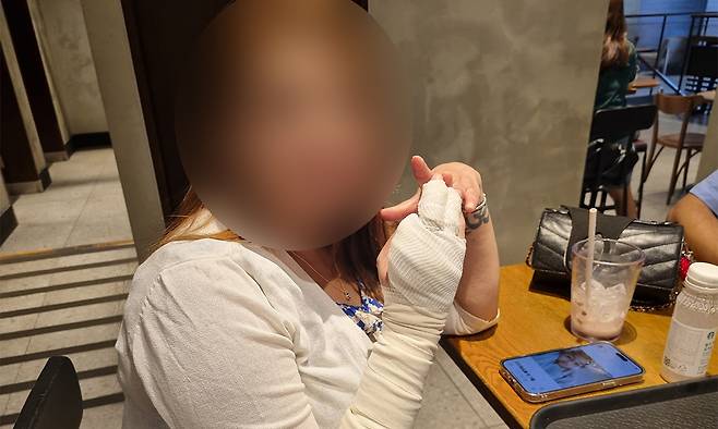 물티슈 공장에서 일하다 산업재해를 당한 라미차 네리아씨가 절단된 손을 보이고 있다. 이지민 기자