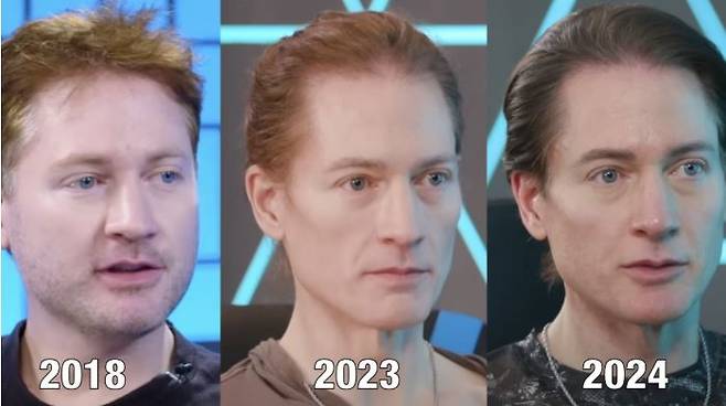 브라이언 존손의 연도별 얼굴 변화. 2018년에 비해 모발이 풍성해진 걸 알 수 있다. 그는 적색광 요법을 매일 하고 있다. 이 요법은 특정 파장이 피부층을 투과해 치유, 항염증 및 회춘 효과를 낸다. [SNS]