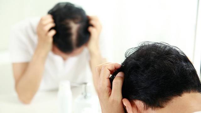 여름철에 두피를 잘 관리해야 가을철 탈모를 막을 수 있다｜출처: 클립아트코리아