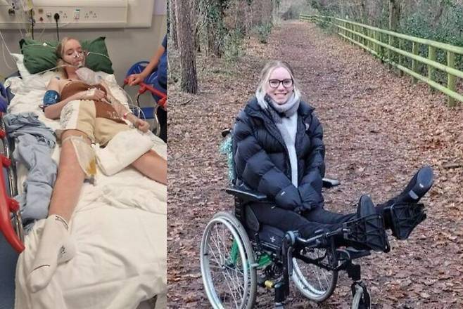 검사를 위해 병원에 입원했던 여성이 2년 만에 전신마비 상태로 깨어나는 믿지 못할 경험을 한 사연이 소개됐다. [사진=SNS]