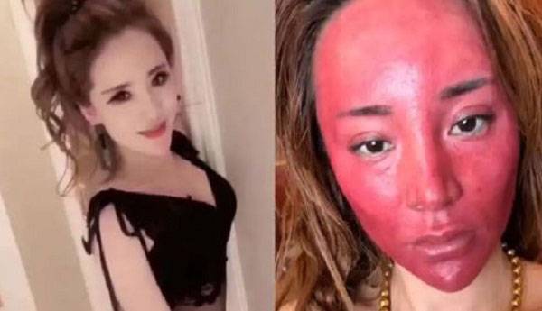 중국의 한 30대 여성이 20년 넘게 화장을 제대로 지우지 않았다가 심각한 부작용을 앓고 있는 사연이 공개돼 화제다. 부작용 겪기 전 여성의 모습(왼)과 부작용 겪은 후 여성의 모습(오)./사진=중화왕