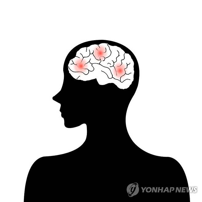 뇌졸중, 뇌출혈 (일러스트)