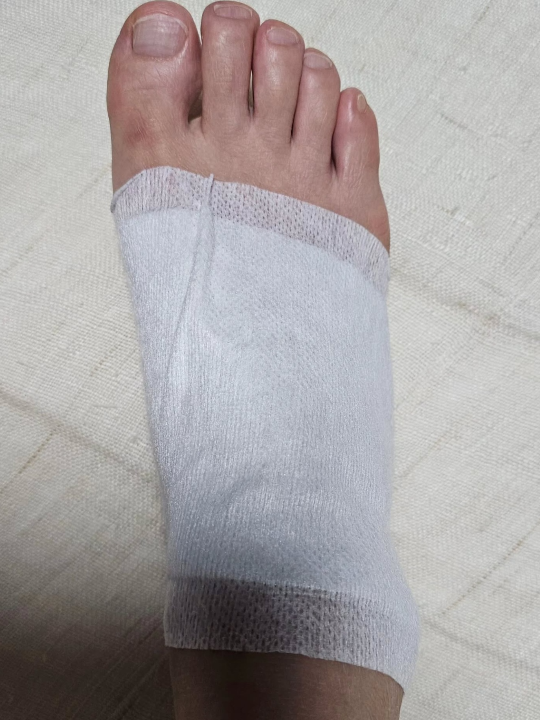 개그우먼 이경실이 SNS에 올린 부상 당한 발 사진. 사진 이경실 페이스북