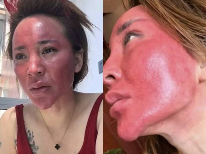 중국 지린성 지린시에 사는 30대 여성은 화장을 한 날에도 물로만 대충 얼굴을 씻거나 귀찮다는 이유로 화장을 지우지 않았다. [사진=SNS]