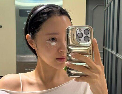 이솔이가 현재 치료 중인 한관종은 가려움, 통증 등 증상은 없지만 방치하면 크기가 커지고 개수가 늘어날 수 있다. [사진=SNS]