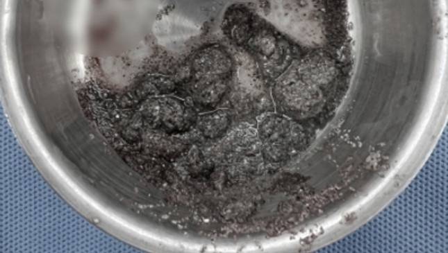 수술 시 제거한 모래(온동물의료센터 제공) ⓒ 뉴스1