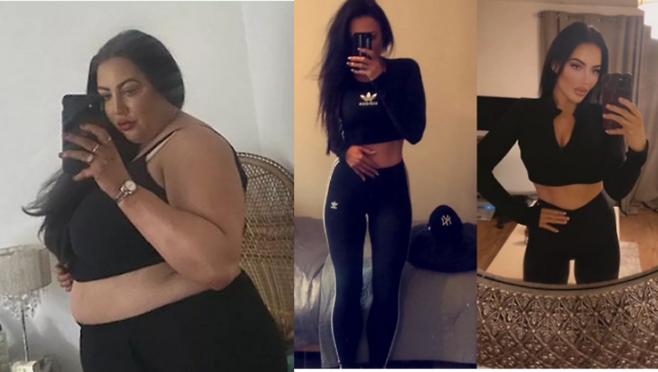 뇌하수체 종양에 의한 호르몬 이상인 쿠싱병으로 인해 64kg 늘어 130kg에 육박했던 한 여성이 2년 만에 몸무게 절반을 빼 65kg가 된 사연을 공유했다. [사진=SNS]