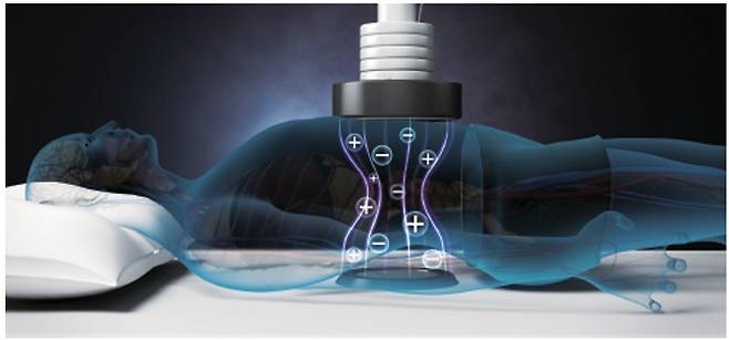 고주파 온열치료는 인체 스스로 열을 만들어 안정적으로 심부열을 발생한다. 이로 인해 체온이 올라가는데, 암세포가 견디지 못하는 40~43도까지 심부열(몸속 조직의 온도)을 끌어올려 암을 괴사하는 원리다. /그림제공=아디포랩스