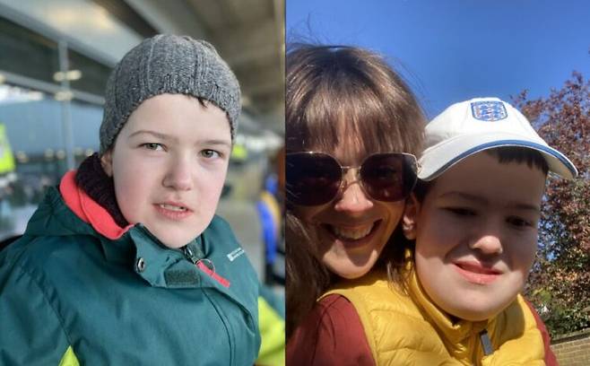 뇌에 셀 수 없이 많은 종양을 가지고 살아가는 아이의 사연이 소개됐다. [사진=SNS]