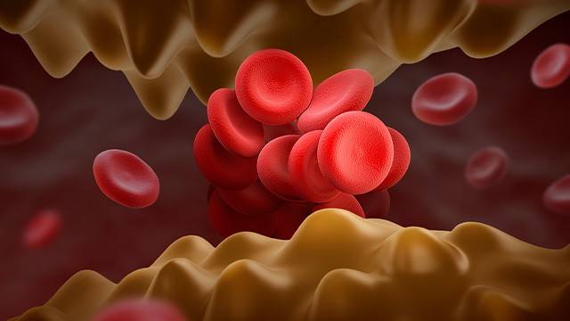 이상지질혈증은 꾸준히 관리해야 하는 만성질환이다｜출처: 클립아트코리아
