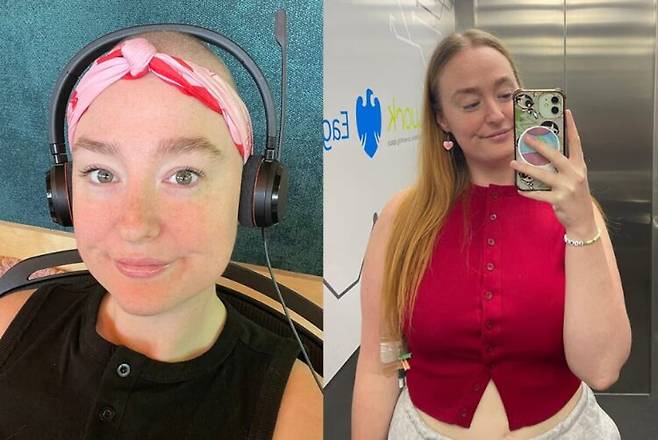 20대 여성이 흔한 성관계 후 통증과 출혈을 대수롭지 않게 여기다 결국 3기 자궁경부암을 진단받은 사연이 전해졌다.[사진=SNS]