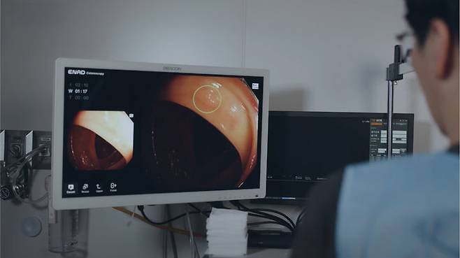 [서울=뉴시스] 아이넥스가 개발한 에나드(ENAD)는 위∙대장내시경 검사 중 실시간으로 병변을 검출하고 화면에 표시해 의료진의 빠르고 정확한 판단을 보조하는 AI 소프트웨어 의료기기이다. (사진=아아넥스 제공) 2025.06.27. photo@newsis.com *재판매 및 DB 금지