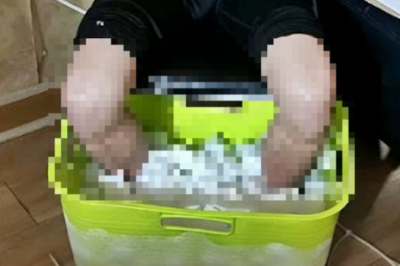 보험금을 타기 위해 몸을 동여맨 채 드라이아이스에 10시간 동안 발을 담갔다가 끝내 양다리만 절단한 대만 남성. 사진은 범행 당시 모습. SCMP 캡처