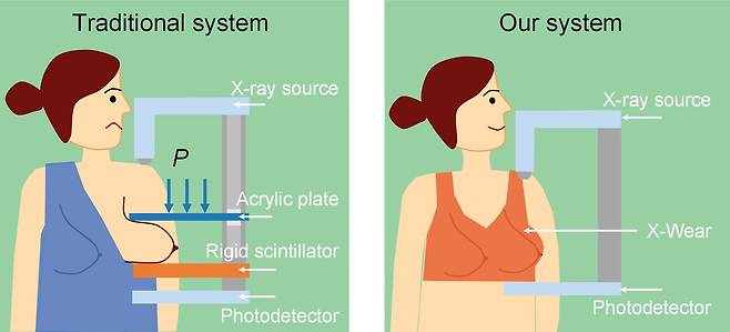 기존 유방암 검사(왼쪽)는 딱딱한 기판에 신체를 대고 압박하면 X선이 인체를 통과하고 감광 소자(scintillator)가 이를 가시광선으로 바꾼다. 최종적으로 광검출기(photodetector)가 빛을 받아 영상을 만든다. 중국 연구진은 감광 소자를 딱딱한 기판 대신 유연한 섬유 형태(X-Wear)로 만들어 신체 압박 없이 영상을 얻을 수 있도록 했다(오른쪽)./Science Advances