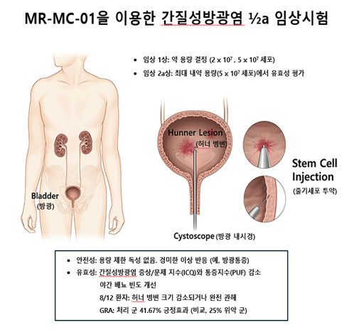 줄기세포 치료제(MR-MC-01)를 이용한 간질성 방광염 1/2a 임상시험 요약 (제주대학교 제공)