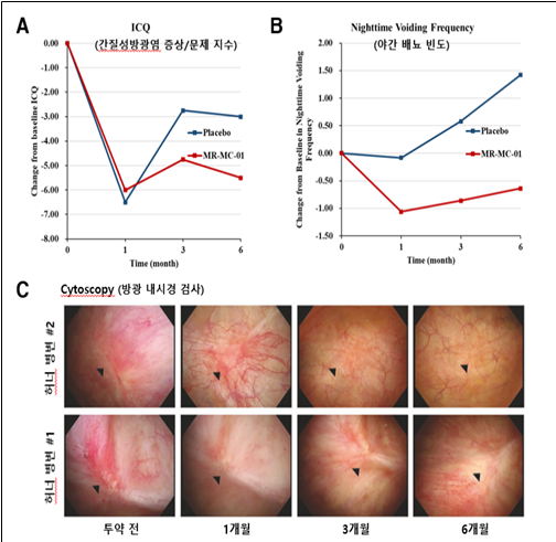 줄기세포치료제 MR-MC-01를 이용한 간질성 방광염 1/2a 임상시험 유효성 평가 (제주대학교 제공)