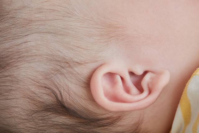 3D프린팅 기술을 접목한 귀 재건술이 정교하고 균일한 결과물을 기대할 수 있어 주목받고 있다. 사진은 기사의 특정 사실과 관련 없음. 게티이미지뱅크