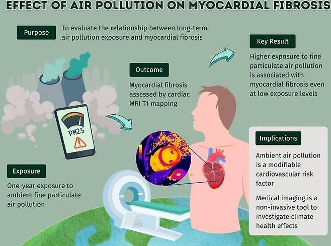 대기오염이 심근 섬유화에 미치는 영향 연구 개요.  심장 MRI 결과 초미세먼지(PM2.5)에 장기간 노출되면 확장성 심근병증 환자 및 정상인 모두 심근 섬유화(myocardial fibrosis) 증상이 증가하는 것으로 나타났다. [Radiological Society of North America(RSNA) 제공. 재판매 및 DB 금지]