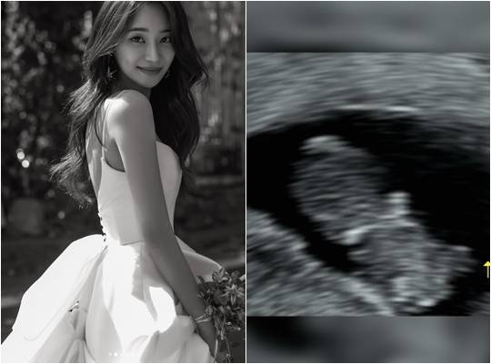 유나 / 사진=개인계정