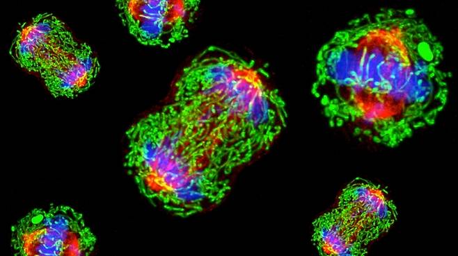 삼중음성유방암은 표적 항암제가 작용하는 3가지 수용체가 모두 없는 악성 유방암이다. 여성 암 중 전이나 재발 위험이 커 최악의 암으로 알려져 있다. 국내 연구진이 혈액 검사만으로 삼중음성유방암 재발 우려를 조기 예측할 수 있는 기술을 개발해 눈길을 끈다. 사진은 삼중음성유방암 세포를 전자현미경으로 촬영한 것.  미국 MD 앤더슨 암센터 제공