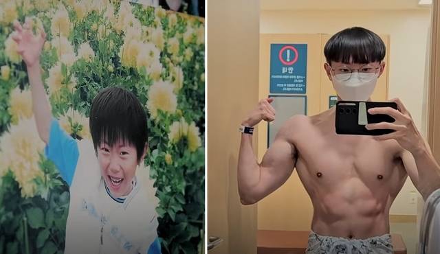 서울아산병원 유튜브 캡처.