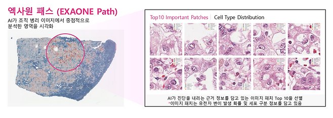 LG AI연구원의 ‘엑사원 패스 2.0’은  병리 조직 이미지를 분석해 암과 관련된 유전자 변이를 예측할 수 있다. [LG 제공]