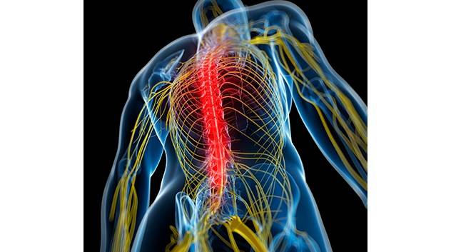 신경근병증은 팔이나 다리로 퍼지는 저림, 통증, 감각 이상, 근력 저하 등의 증상을 동반한다｜출처: 클립아트코리아