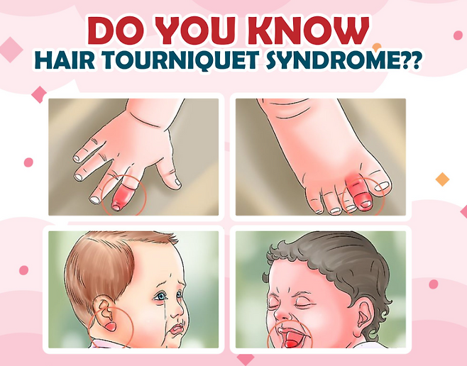 미국 아칸소에서 15개월 아기가 누나의 긴 머리카락에 목이 졸려 기절하는 사고가 발생했다. 빠른 응급조치로 무사히 회복했지만, 의료진은 긴 머리카락처럼 일상 속 물건도 영유아에겐 치명적일 수 있다며 주의를 당부했다. (사진=SNS)