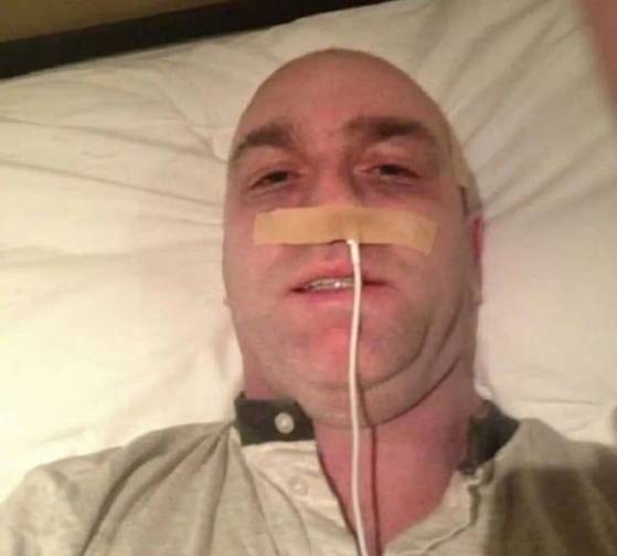 데니스 조셉 케리가 콧구멍에 아이폰 충전기를 꽂은 모습. 사진 더선 캡처