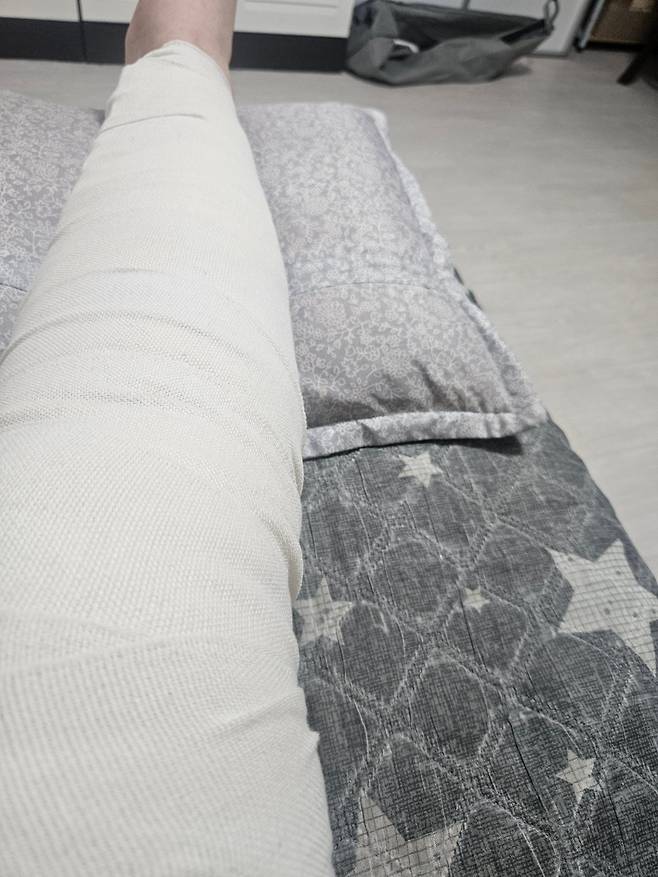 습관성 무릎탈구 이후 저의 현재상태