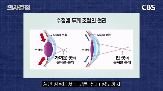 강남아이오케이안과의원 오영삼 대표원장. '의사결정' 유튜브 캡처