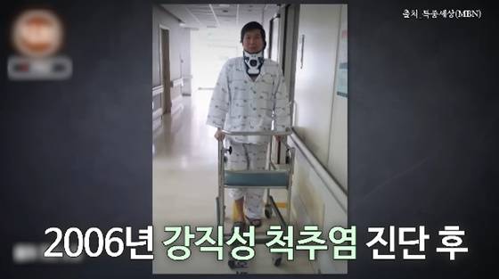 자취 감췄던 김시덕 "강직성 척추염 앓아, 현재는 완전 멀쩡..주사 치료도 NO"