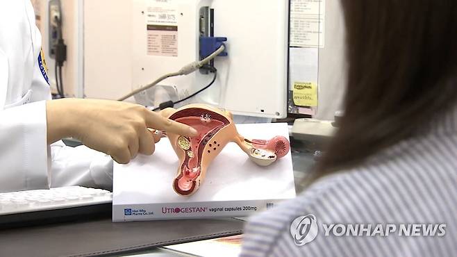 체외수정 [연합뉴스TV 제공]