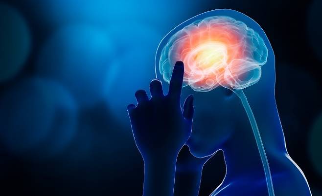 전기 자극으로 파킨슨병 증상을 완화하는 기존 뇌심부자극술(DBS)이 최근 미국과 유럽 당국의 승인을 받았다. 게티이미지뱅크 제공