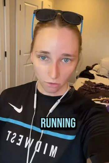 사고 후 목 수술을 받은 뒤 ‘할리퀸 증후군(얼굴 반쪽만 홍조가 생기고 땀이 나는 증상)’을 앓게 된 시드니 패트리스/사진=뉴욕포스트