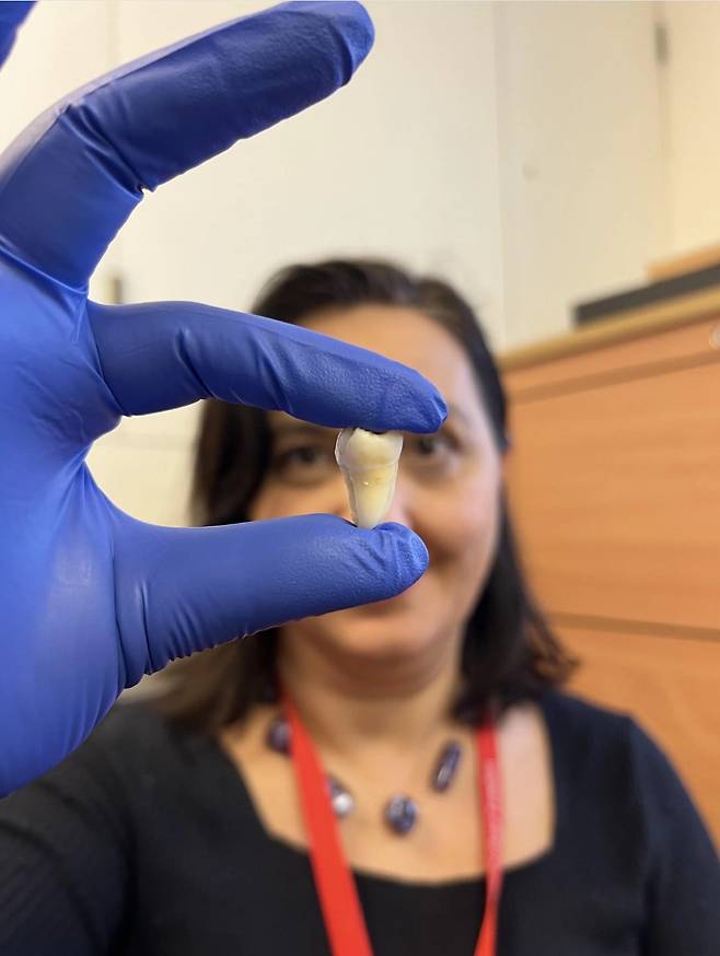 치아를 들고 있는 애나 볼포니 킹스칼리지런던 박사. /킹스칼리지런던