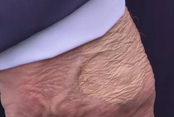 도널드 트럼프 미국 대통령 손등의 화장 자국./데일리메일