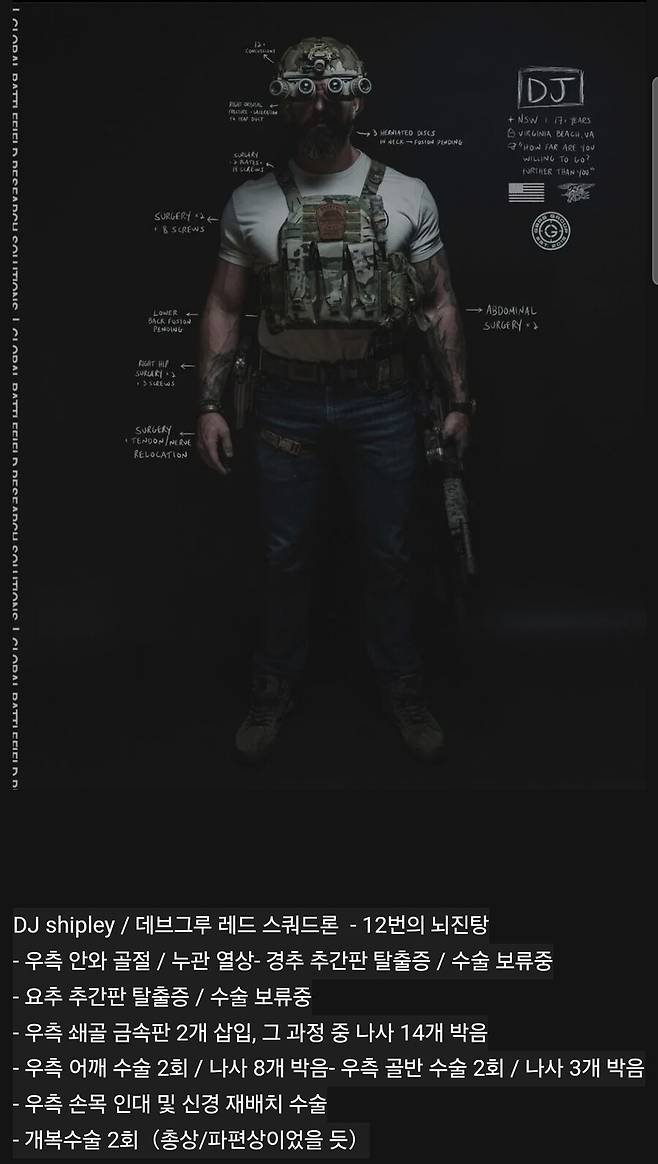 img/23/09/29/18ae0ad0170559594.jpg 17년 근무한 미 특수부대 대원 신체 상태.jpg 17년 근무한 미 특수부대 대원 신체 상태.jpg