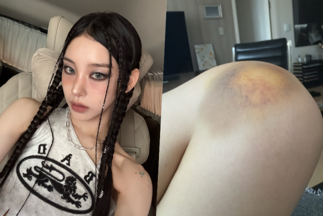 노제 / 소셜미디어